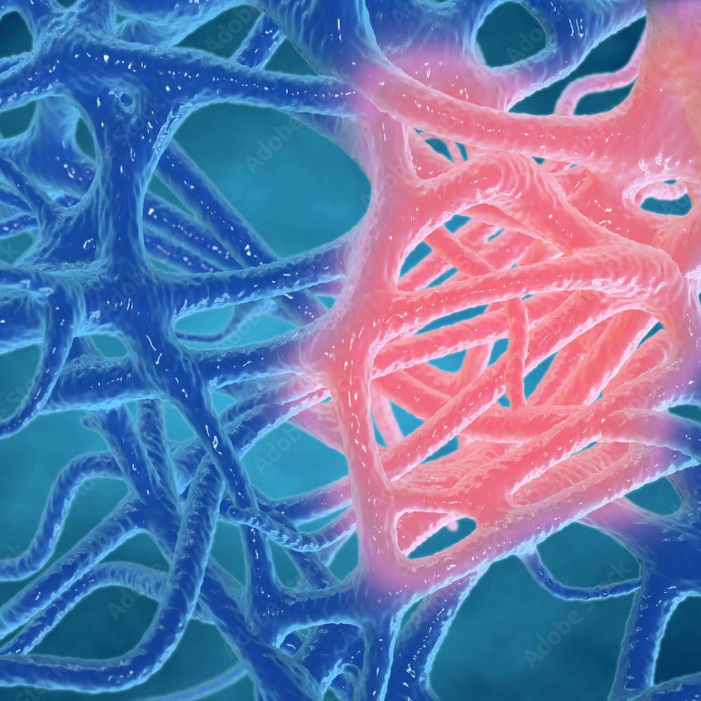 Where Low-Grade Inflammation Comes From and Why It’s Potentially Harmful